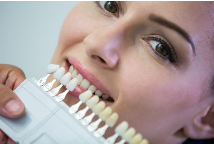 Enhance Your Confidence with Premium Quality Veneers