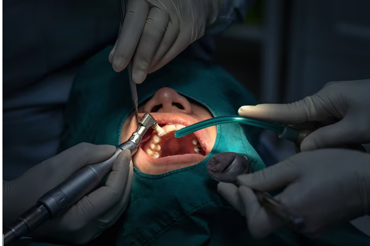 The Role of Dental Surgeons in Restorative and Cosmetic Dentistry