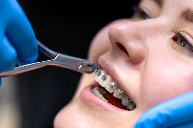 What to Expect During Your First Orthodontic Consultation in Abu Dhabi