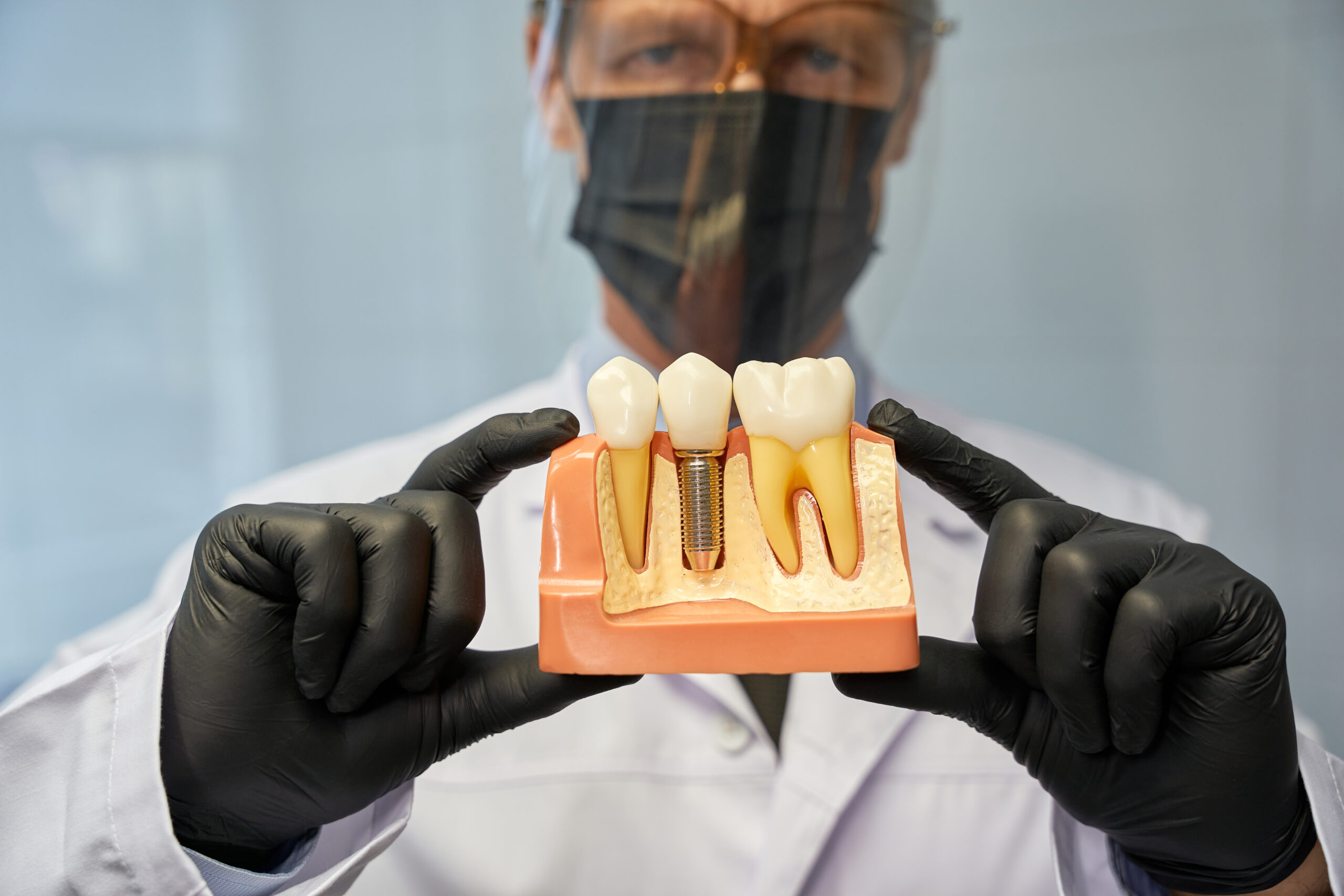 DENTAL-IMPLANTS