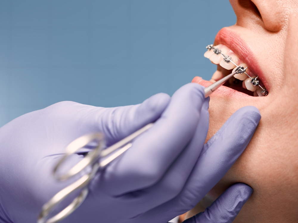 ORTHODONTICS