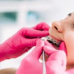 ceramic braces in abu dhabi