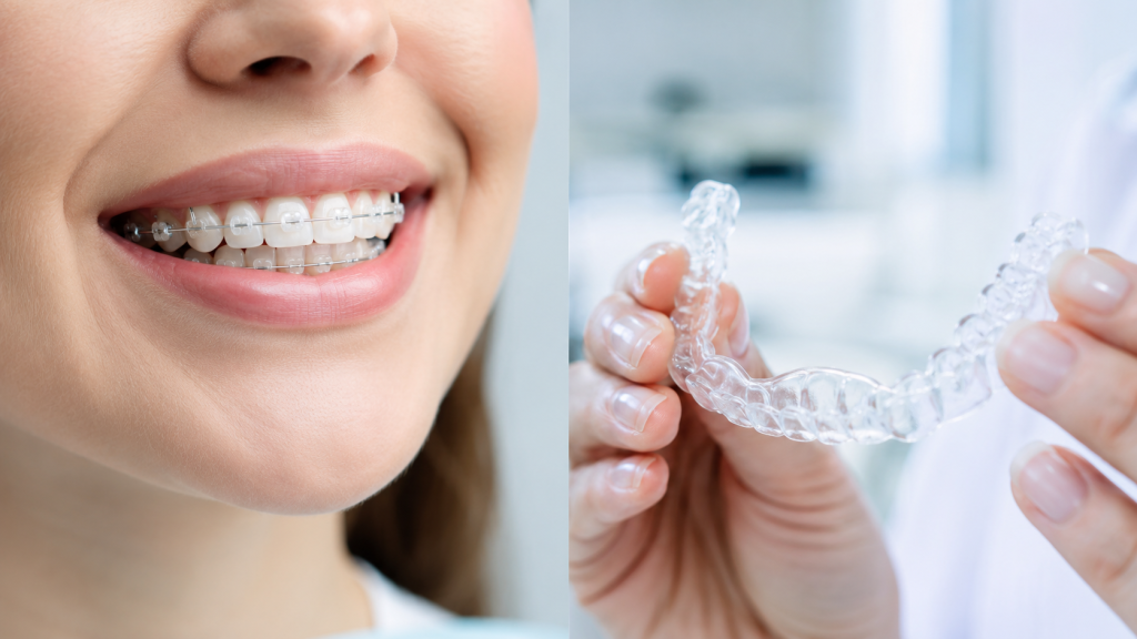 Braces vs Invisalign comparison California Medical Center Abu Dhabi