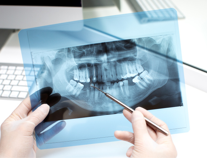 Digital dental X rays in Abu Dhabi at California Medical Center