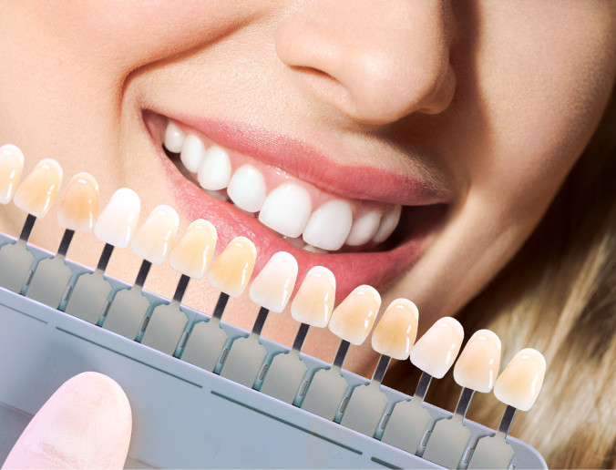 Cosmetic dentistry in Abu Dhabi at California Medical Center